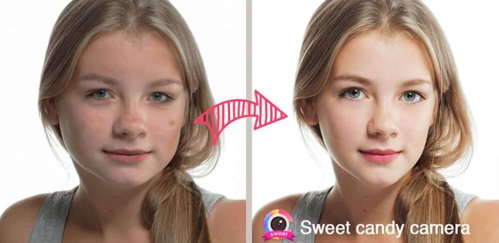 Sweet Candy Cam v4.8.1726 MOD APK (Premium Unlocked)